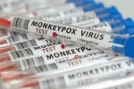 Variole du singe : premier cas de transmission à un chien ! Faut-il s&rsquo;inquiéter ?
